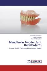 Mandibular Two-Implant Overdentures