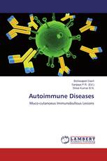 Autoimmune Diseases