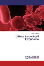 Diffuse Large B-cell Lymphoma