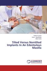 Tilted Versus Nontilted Implants In An Edentulous Maxilla