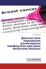 Диагностика поражения регионарных лимфоузлов при раке молочной железы