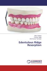 Edentulous Ridge Resorption