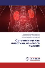 Ортотопическая пластика мочевого пузыря