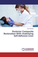 Posterior Composite Restoration With Underlying Self-Adhesive Liner