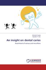 An insight on dental caries