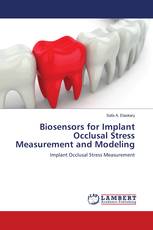 Biosensors for Implant Occlusal Stress Measurement and Modeling