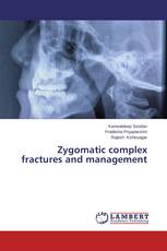 Zygomatic complex fractures and management