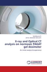 X-ray and Optical CT analysis on normoxic PAGAT gel dosimeter