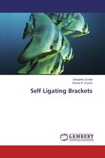 Self Ligating Brackets