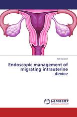 Endoscopic management of migrating intrauterine device