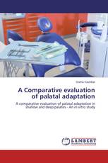A Comparative evaluation of palatal adaptation