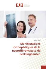 Manifestations orthopédiques de la neurofibromatose de Recklinghausen