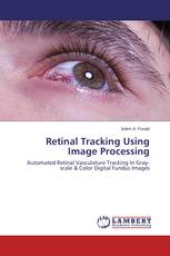 Retinal Tracking Using Image Processing
