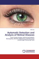 Automatic Detection and Analysis of Retinal Diseases