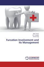 Furcation Involvement and Its Management