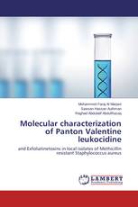 Molecular characterization of Panton Valentine leukocidine
