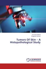 Tumors Of Skin – A Histopathological Study