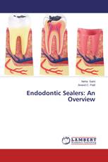 Endodontic Sealers: An Overview