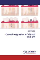 Osseointegration of dental implant
