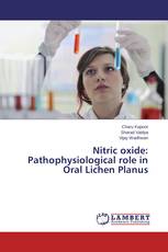 Nitric oxide: Pathophysiological role in Oral Lichen Planus