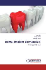 Dental Implant Biomaterials