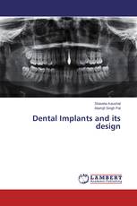 Dental Implants and its design