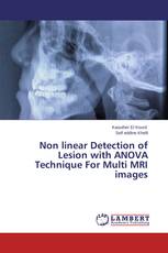 Non linear Detection of Lesion with ANOVA Technique For Multi MRI images