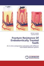 Fracture Resistance Of Endodontically Treated Teeth