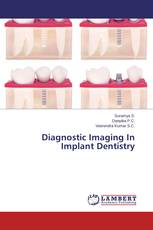 Diagnostic Imaging In Implant Dentistry