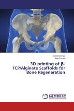 3D printing of β-TCP/Alginate Scaffolds for Bone Regeneration