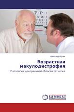 Возрастная макулодистрофия