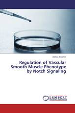 Regulation of Vascular Smooth Muscle Phenotype by Notch Signaling