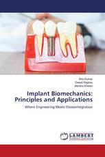 Implant Biomechanics: Principles and Applications