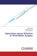 Lignocaine versus Articaine in Third Molar Surgery