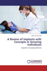 A Review of Implants with Concepts in Growing Individuals