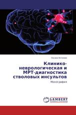 Клинико-неврологическая и МРТ-диагностика стволовых инсультов