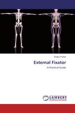 External Fixator