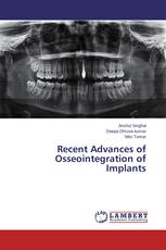 Recent Advances of Osseointegration of Implants