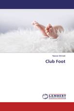 Club Foot