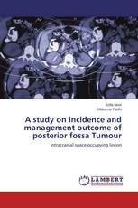 A study on incidence and management outcome of posterior fossa Tumour