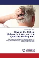 Beyond the Flakes: Malassezia furfur and the Quest for Healthy Hair