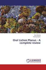 Oral Lichen Planus - A complete review