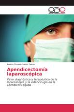 Apendicectomía laparoscópica