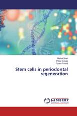 Stem cells in periodontal regeneration
