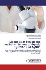 Diagnosis of benign and malignant lesions of thyroid by FNAC and AgNO3