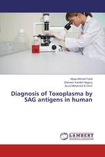 Diagnosis of Toxoplasma by SAG antigens in human