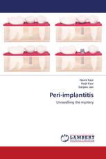 Peri-implantitis