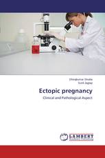 Ectopic pregnancy