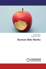Human Bite Marks