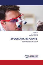 ZYGOMATIC IMPLANTS